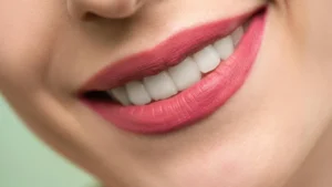 Read more about the article What Is the Cost and Procedure for Porcelain Veneers?